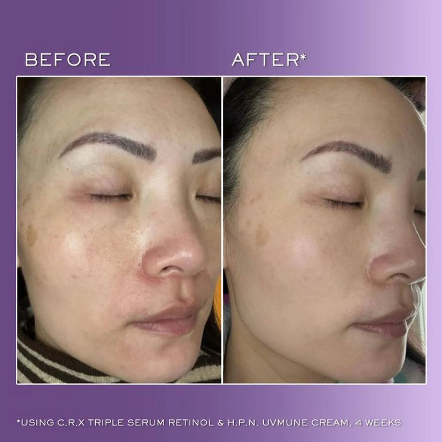 Lancôme Rénergie CRX Triple Serum Night 50ml