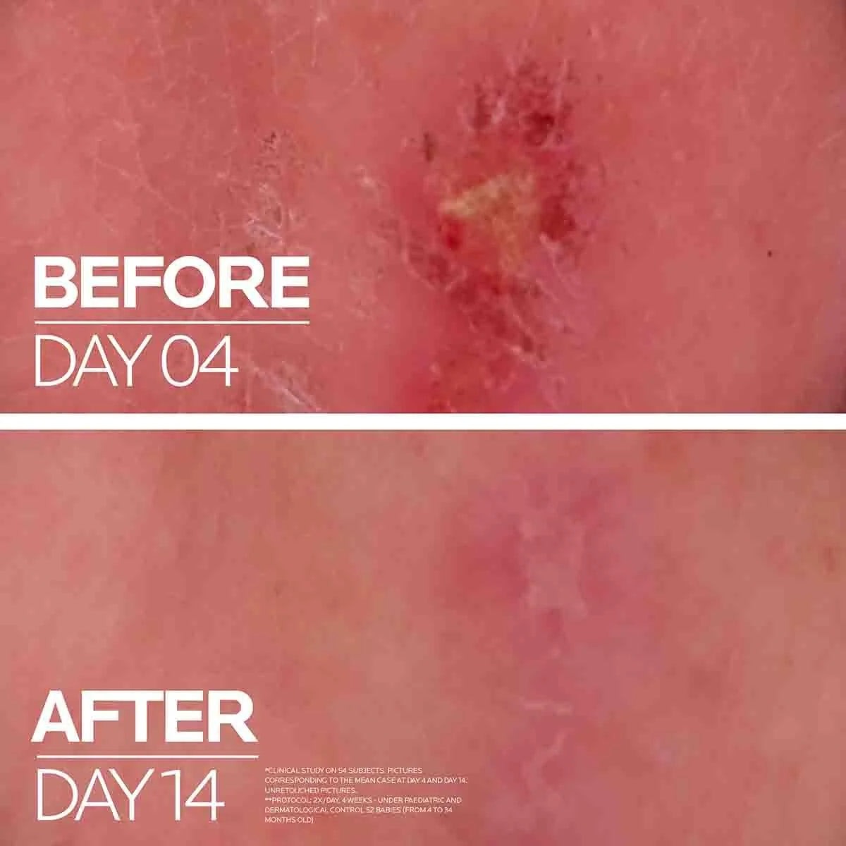 La Roche-Posay Cicaplast Baume B5+ Ultra-Repairing Soothing Balm