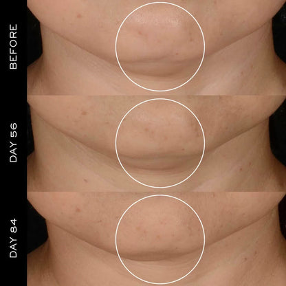 Lancôme Rénergie H.P.N. Ultra Cream 50ml