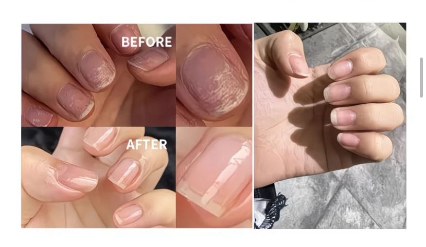 Before and after comparison showing hydrated cuticles after using DHAC liquid