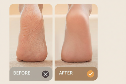 AUX Electric Foot File &amp; Callus Remover 100ml - Professional Pedicure Tool