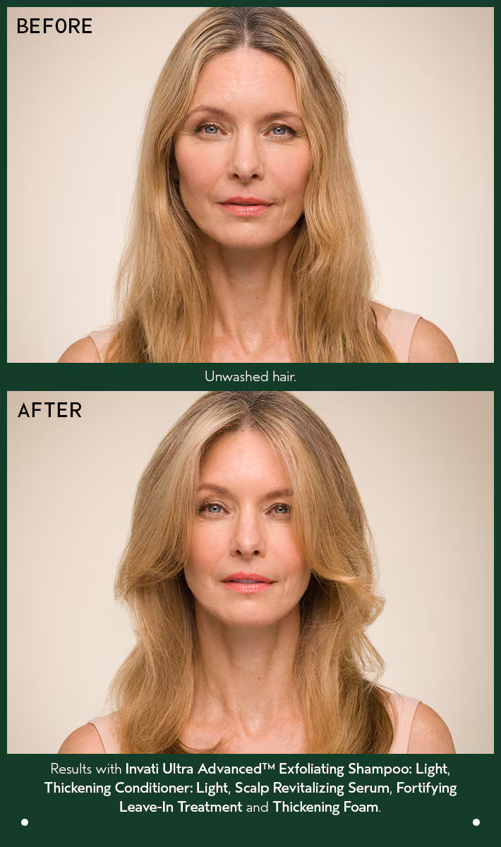 Hair density improvement after 12 weeks with Invati serum